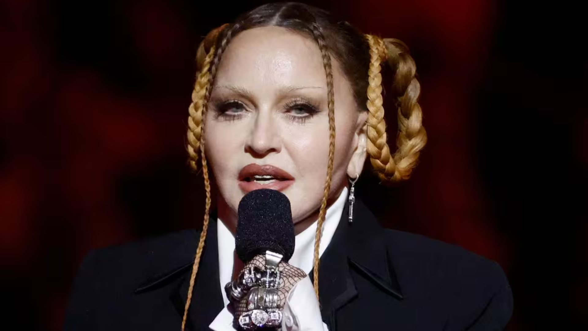 Celebridades: Madonna aparece com rosto inchado em premiação