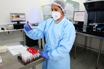 Lacen-Ba lidera número de testes no Brasil, afirma Ministério da Saúde