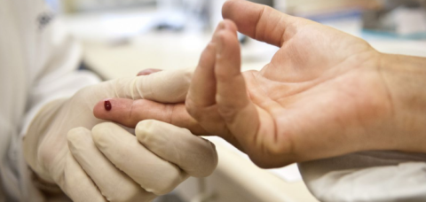 Brasil realiza 1,8 milhão de testes de HIV em 2025, aponta Abramed