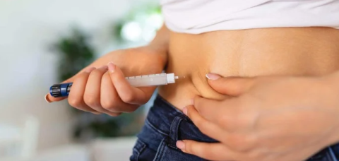 Gastroplastia endoscópica é alternativa às canetas emagrecedoras? Entenda