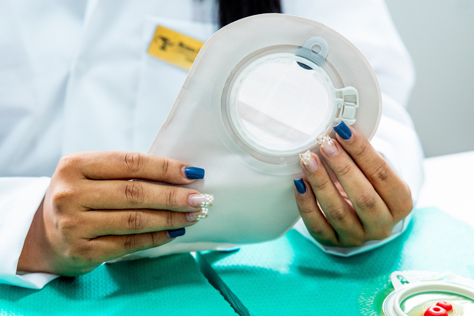 Policlínica de Camaçari inicia atendimento especializado às pessoas ostomizadas